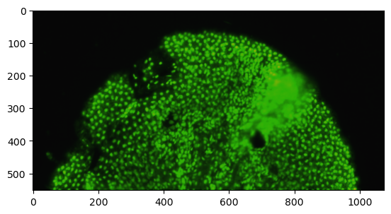 ../_images/Tutorials_cell-segmente-on-ssDNA_5_1.png